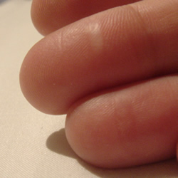 Burnt Fingers