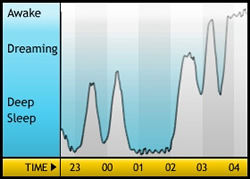 Sleep Patterns