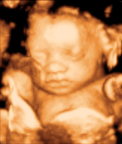 3d Baby Image